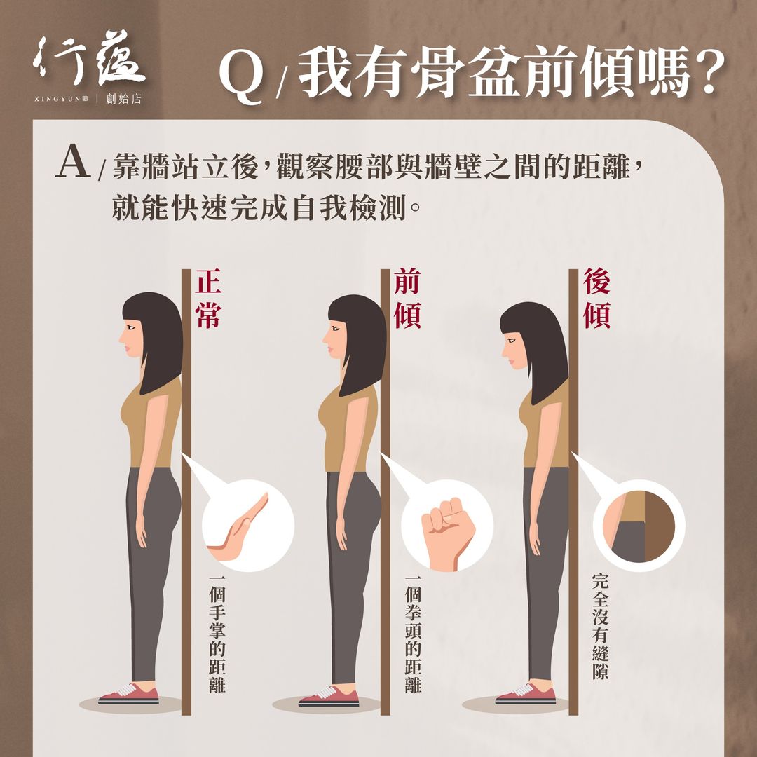 行蘊QA｜我有骨盆前傾嗎 - 行蘊｜健康能量會館